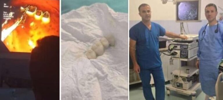 E pazakontë në Pejë: Mjeku nxjerr protezën e dhëmbëve nga lukthi i një pacienti