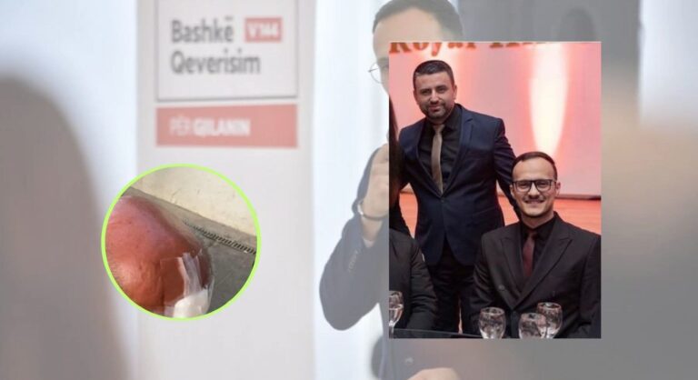 Shefi i kabinetit të Alban Hysenit rrah keq një të moshuar në Gjilan, e lëndon në kokë